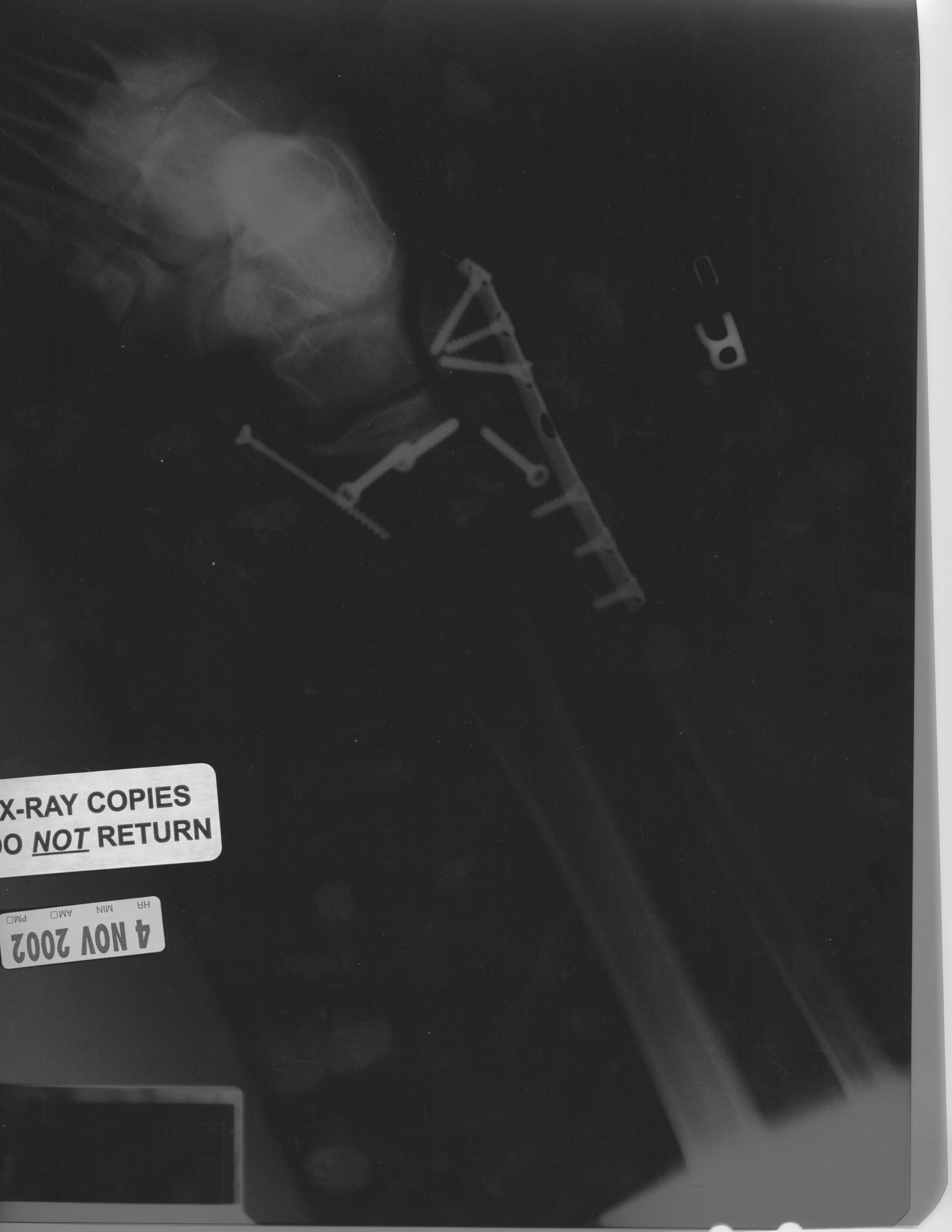 xray.jpg